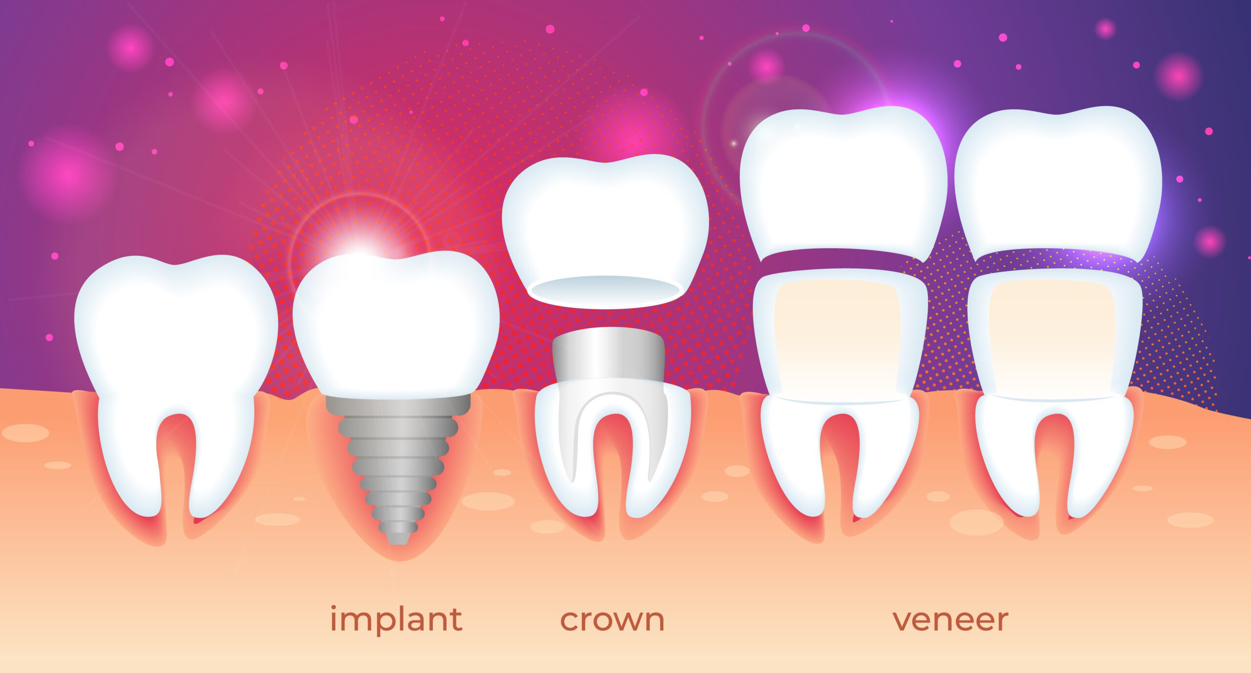 How Much Do Veneers Cost With Insurance A Guide To Your Perfect Smile Patient Empowered Dentistry 3507